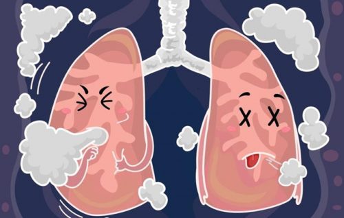 Những vấn đề về phổi thường gặp