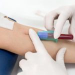 Xét nghiệm máu WBC là gì? Tại sao cần thực hiện xét nghiệm WBC?