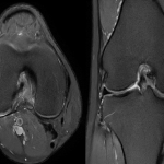 Liệu việc chụp MRI thường xuyên có gây hại không?