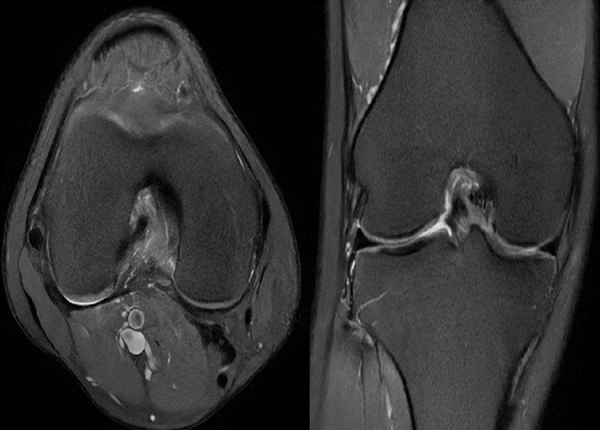 <center><em>Hình ảnh chụp MRI xương khớp rõ nét</em></center>