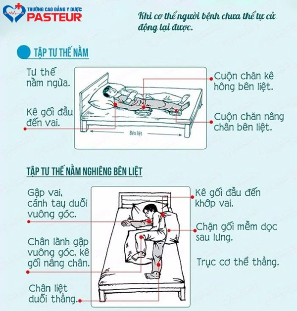 Bài tập Phục hồi chức năng sau tai biến giai đoạn sớm