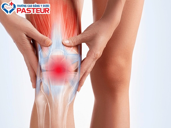 Nguyên nhân gây ra tình trạng đau khớp gối 