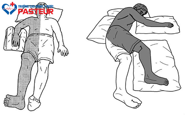 Tìm hiểu về bệnh nhân liệt nửa người