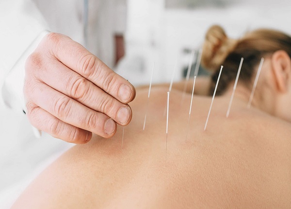 Nội dung chương trình đào tạo Y sĩ Y học cổ truyền