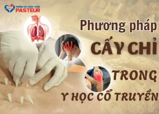 Phương pháp cấy chỉ trong y học cổ truyền: Khái niệm, quy trình và hiệu quả điều trị