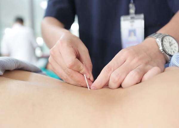 Hiệu quả điều trị của phương pháp cấy chỉ