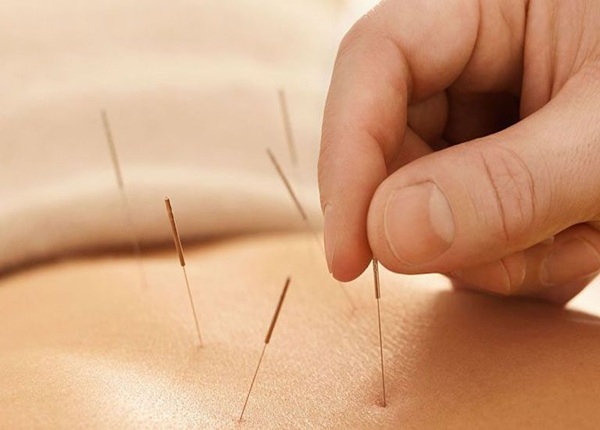 Học Cao đẳng Y học Cổ truyền sẽ học những gì?